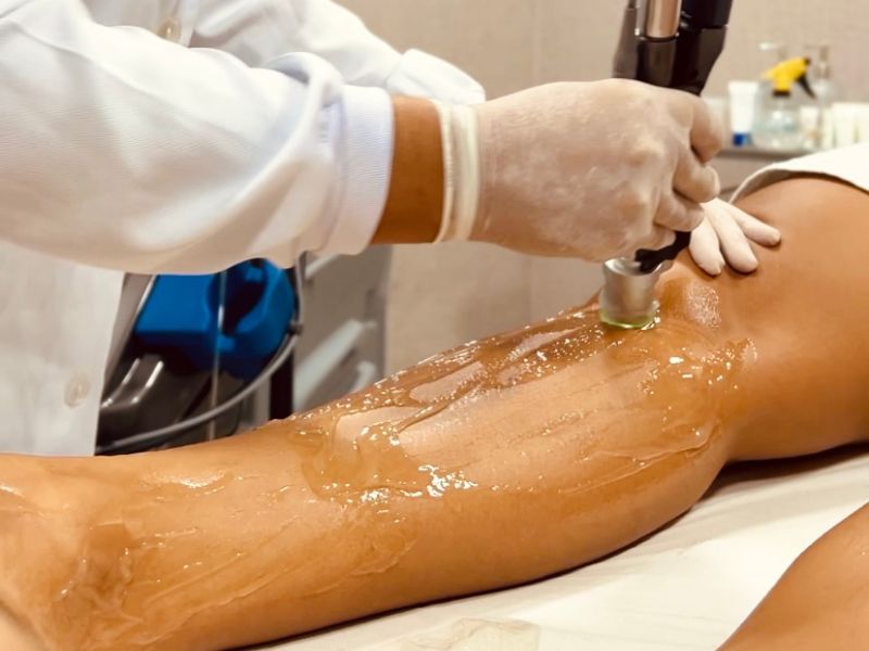 depilacao a laser cuiaba