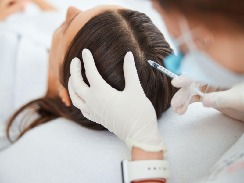 mesoterapia capilar cuiaba