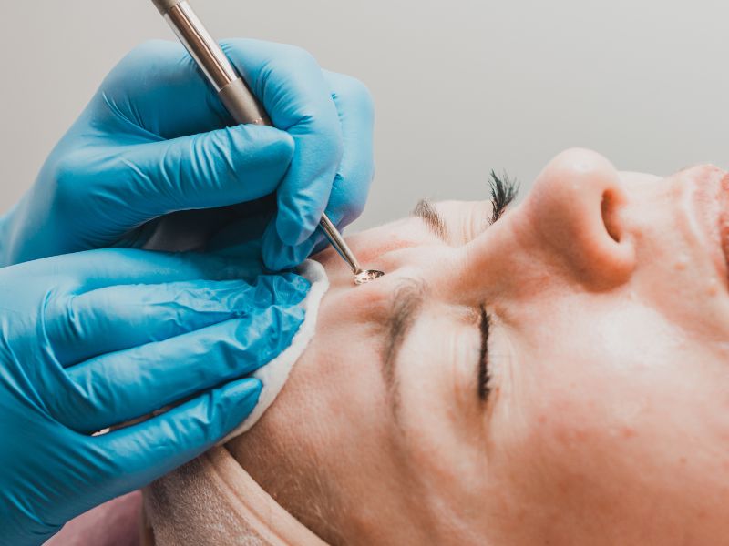 quanto custa limpeza de pele