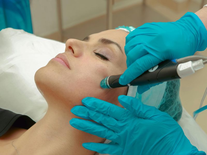 quanto tempo dura uma limpeza de pele​ - frequência