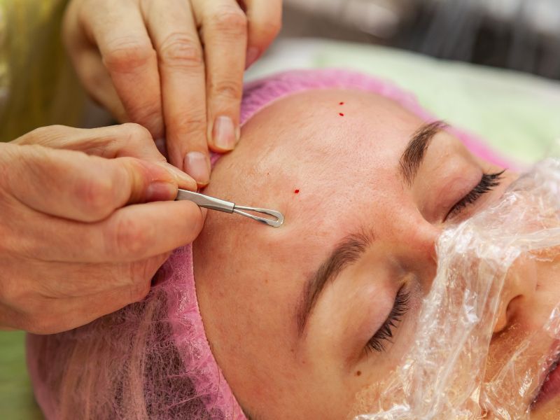 quem pode fazer limpeza de pele