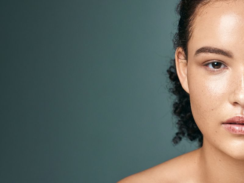 como saber se tenho melasma - grupos