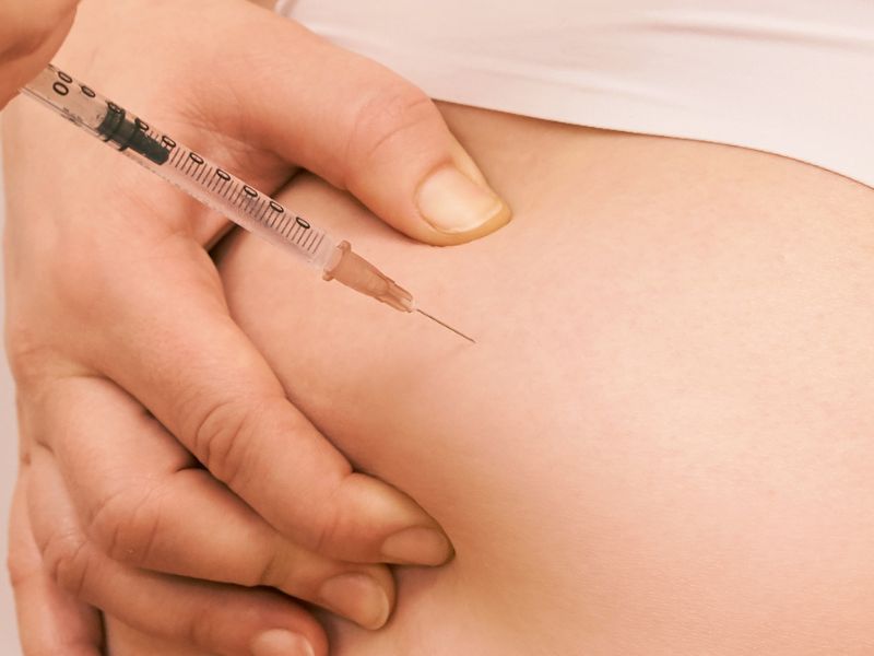 preenchimento de glúteos antes e depois - evolução