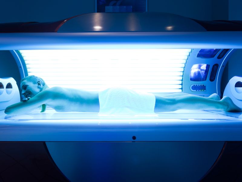 quem tem melasma pode fazer bronzeamento artificial - diferença
