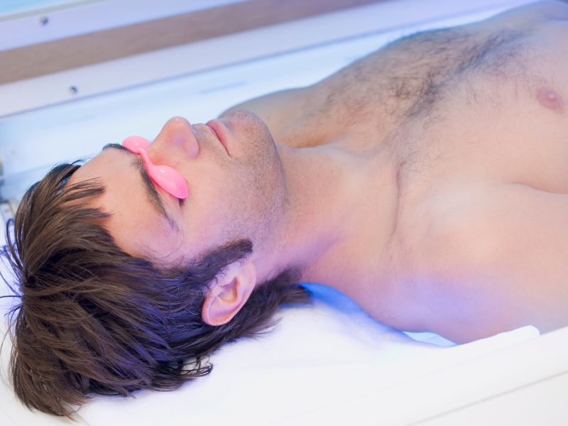 quem tem melasma pode fazer bronzeamento artificial